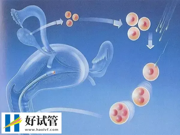 苏州三代试管婴儿费用多少(图1) 三代试管婴儿是目前最先进的试管婴儿技术